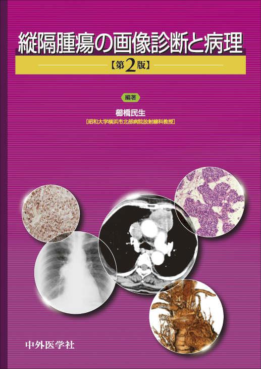 縦隔腫瘍の画像診断と病理　2版