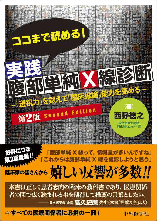 ココまで読める！実践腹部単純Ｘ線診断　2版