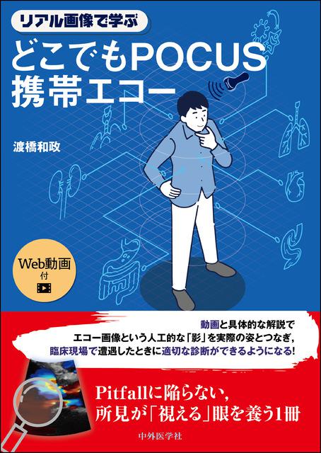 リアル画像で学ぶ　どこでもPOCUS携帯エコー