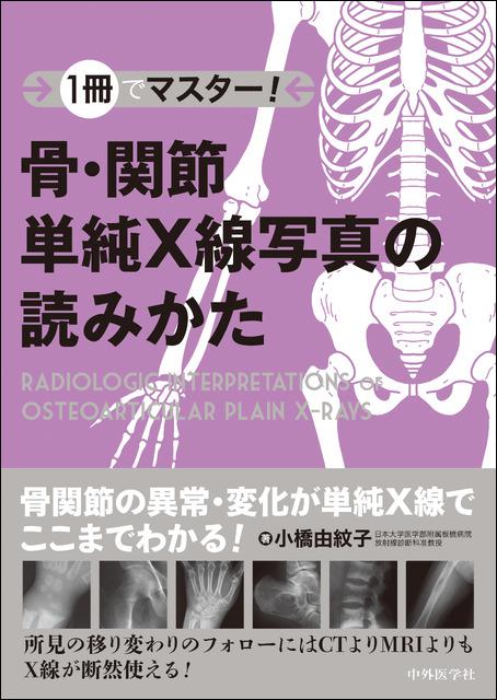 1冊でマスター！　骨・関節単純X線写真の読みかた