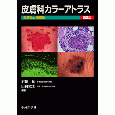 皮膚科カラーアトラス 臨床像と組織像