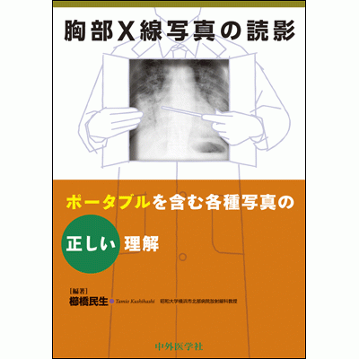 胸部X線写真の読影