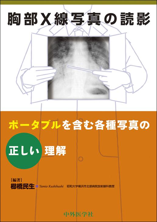 胸部X線写真の読影