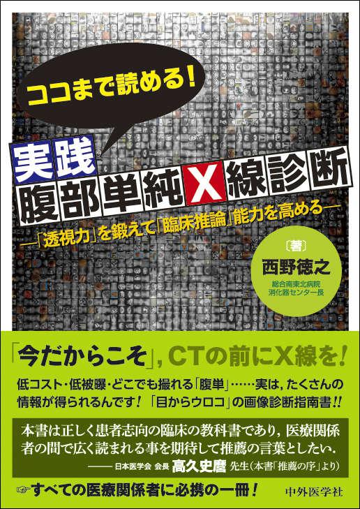 ココまで読める！実践腹部単純Ｘ線診断　