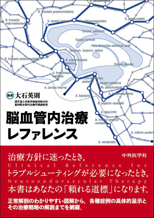 脳血管内治療レファレンス