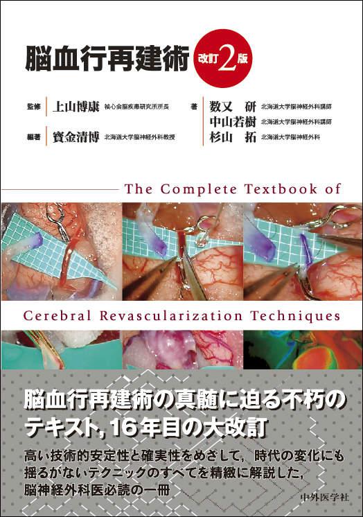 脳血行再建術　2版