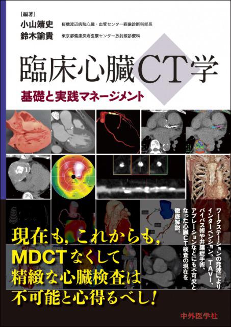臨床心臓CT学−基礎と実践マネージメント