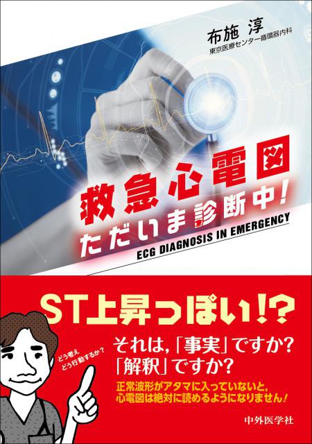 救急心電図　ただいま診断中！