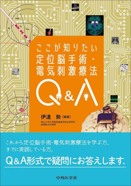 ここが知りたい定位脳手術・電気刺激療法Q&A