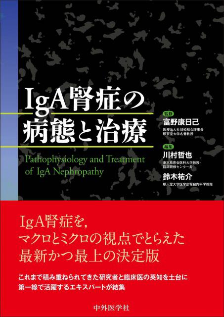 IgA腎症の病態と治療