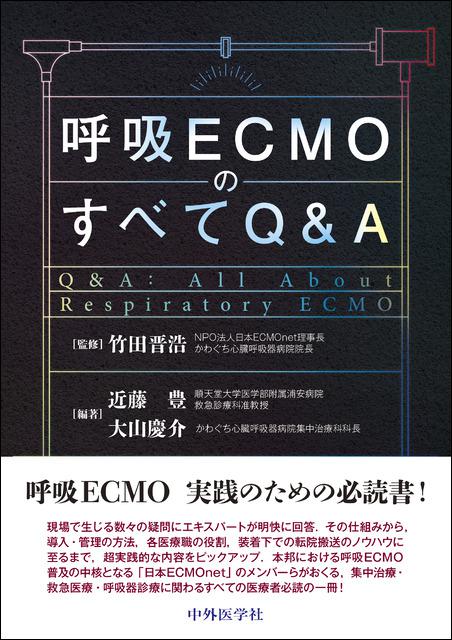 呼吸ECMOのすべてQ&A