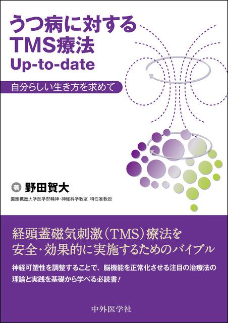 うつ病に対するTMS療法Up-to-date