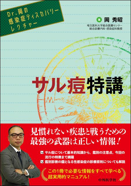 サル痘特講