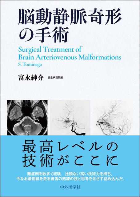 脳動静脈奇形の手術