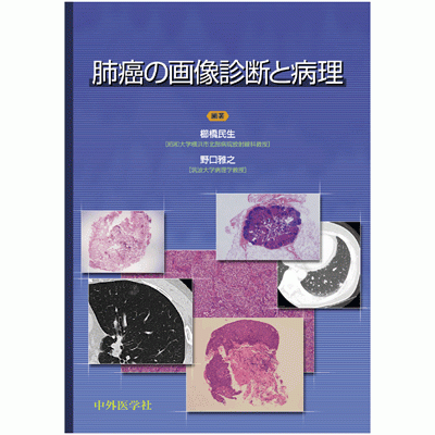 肺癌の画像診断と病理