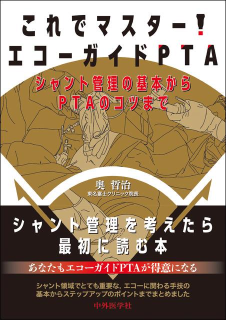 これでマスター！エコーガイドPTA　―シャント管理の基本からPTAのコツまで