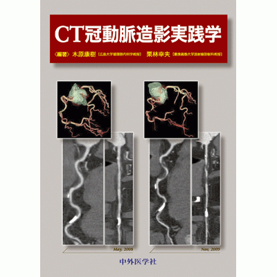 CT冠動脈造影実践学