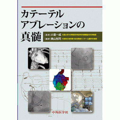 カテーテルアブレーションの真髄