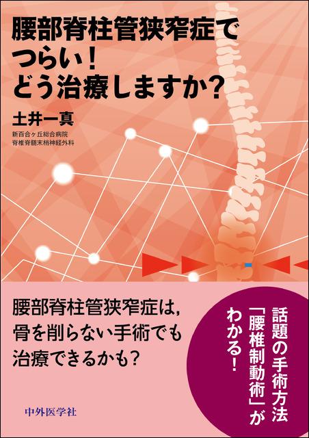 腰部脊柱管狭窄症でつらい！どう治療しますか？