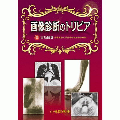 画像診断のトリビア