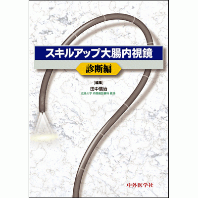 スキルアップ大腸内視鏡 診断編