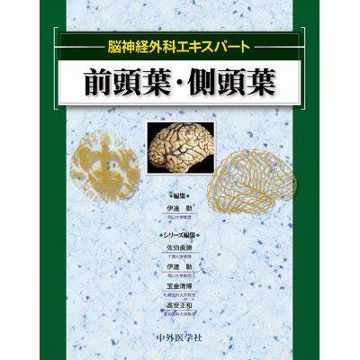 脳神経外科エキスパート 前頭葉・側頭葉
