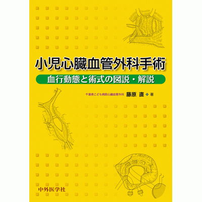 小児心臓血管外科手術