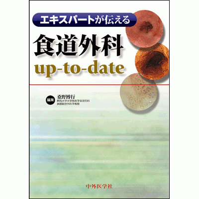 エキスパートが伝える食道外科up-to-date