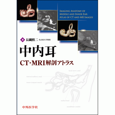 中内耳CT・MRI解剖アトラス