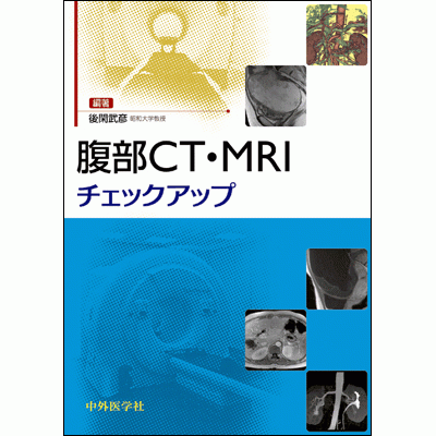 腹部CT・MRIチェックアップ